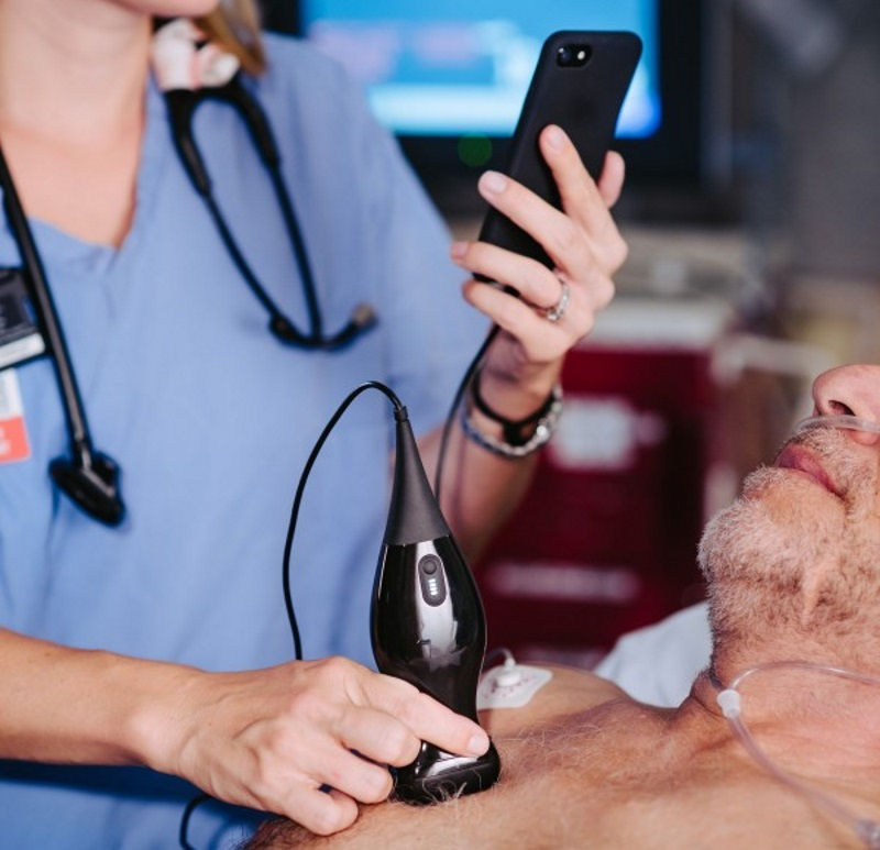 iphone_ultrasound_mit_1509340335487